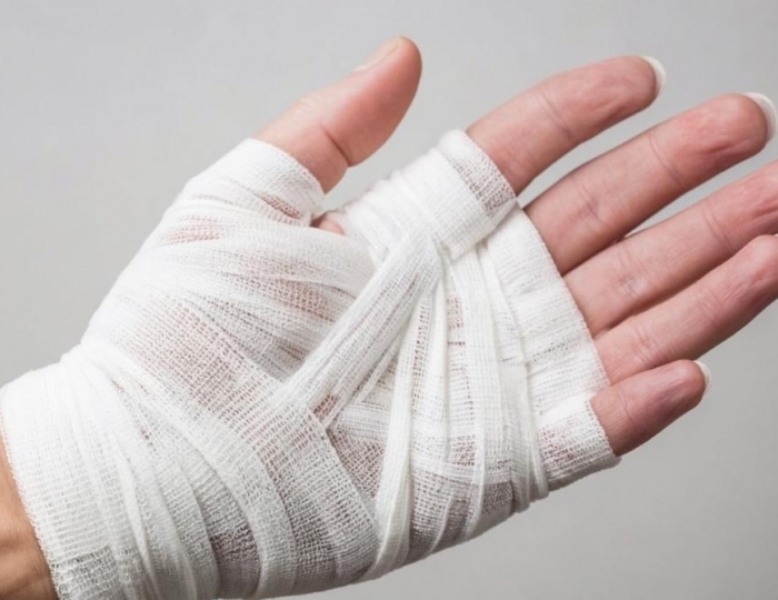 Послеожоговая терапия - Клинический санаторий «Металлург» Сочи