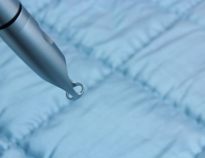 Лазеротерапия - Пансионат «ФЕЯ SUNCLUB RESORT & SPA»